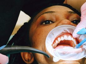 Opalescence Tandblegning: Opnå et Strålende Smil